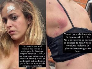 Una joven de Borriol denuncia en redes la agresión sufrida en Castellón