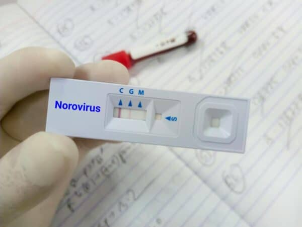 El Norovirus se propaga en España